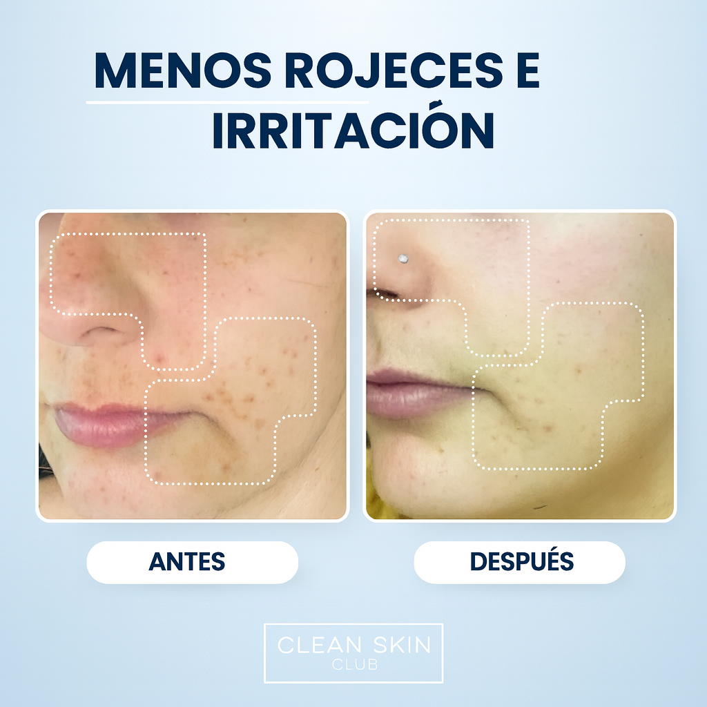 Toallas Faciales Clean XL – Piel Sensible & Acné