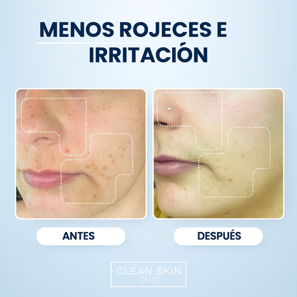 Toallas Faciales Clean XL – Piel Sensible & Acné